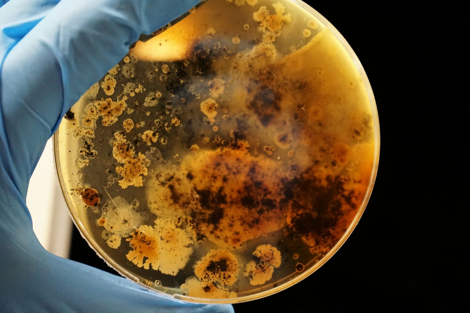 A História da Descoberta das Bactérias no Mundo: Um Marco na Ciência e na Medicina